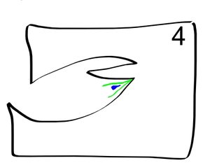 После построения обоих &quot;средних линий&quot; (зелёный цвет) останется &quot;артефактное место&quot; (синее озерцо) -- коническая фреза оставит бугорок, а цилиндрическая вовсе не дойдёт сюда. (5954 просмотра) <a class='original' href='./download/file.php?id=241&mode=view' target=_blank>Загрузить оригинал (26.8 КБ)</a>