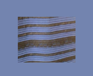 Платье (2542 просмотра) <a class='original' href='./download/file.php?id=44479&mode=view' target=_blank>Загрузить оригинал (61.62 КБ)</a>