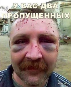 d711bf21-b4b9-45e7-b8db-cccd8d7a7626.jpg (2453 просмотра) <a class='original' href='./download/file.php?id=69452&mode=view' target=_blank>Загрузить оригинал (30.34 КБ)</a>