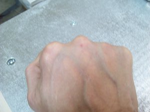 Фото не гуглить, бесполезно... Не толерантно, конечно, но эффективно. Проверено. Как врач, не рекомендую. (1900 просмотров) <a class='original' href='./download/file.php?id=70768&mode=view' target=_blank>Загрузить оригинал (462.36 КБ)</a>